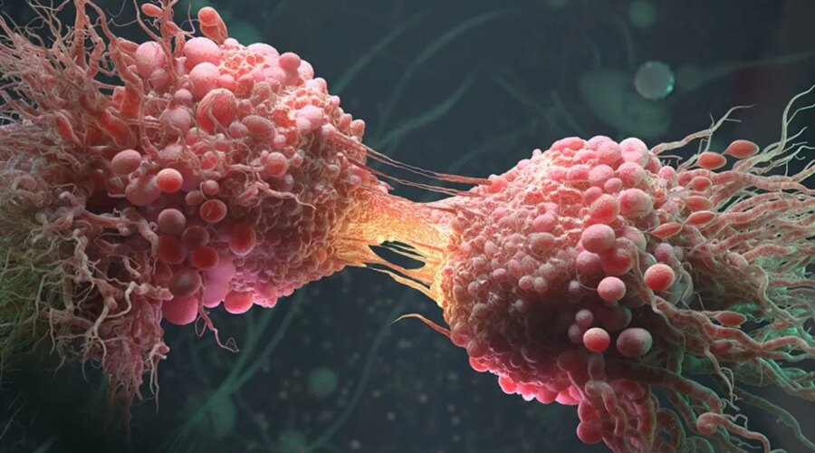 kanser kelimesi eskisi gibi son anlamina gelmiyor basari orani 2 kat artti UBugOsiu